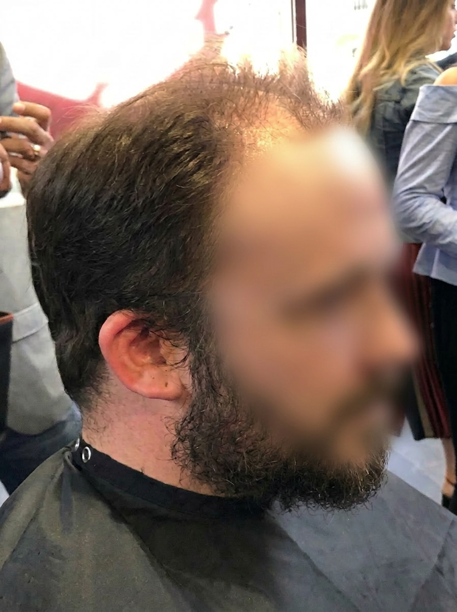 Μετά την αποκατάσταση πυκνότητας