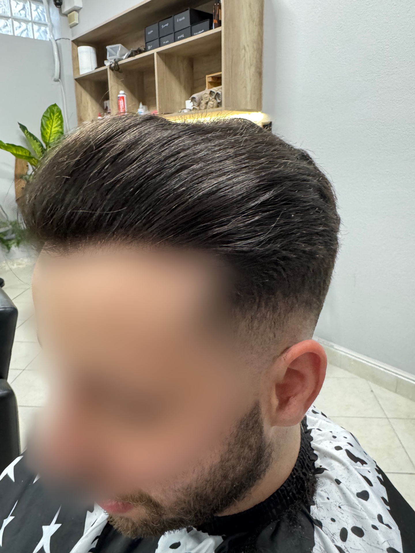 Μετά το νέο hair system