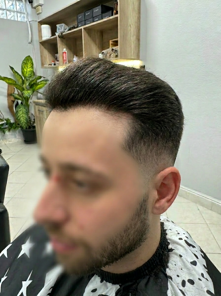 Μετά το curly hair system